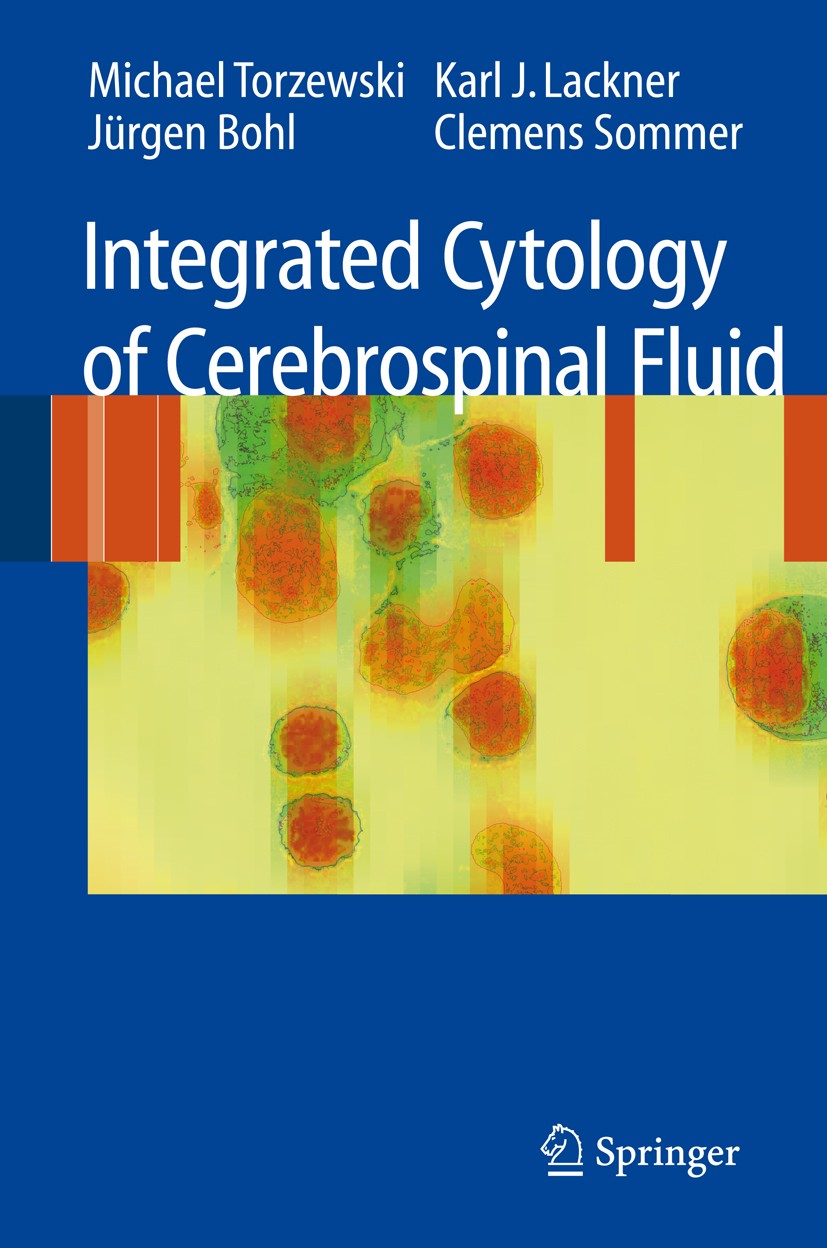 Titlebook: Integrated Cytology of Cerebrospinal Fluid; Michael Torzewski Book 2008 Springer-Verlag Berlin Heidelberg 2008 Nervous System.Pathologie.i Titlebook: Integrated Cytology of Cerebrospinal Fluid; Michael Torzewski Book 2008 Springer-Verlag Berlin Heidelberg 2008 Nervous System.Pathologie.i