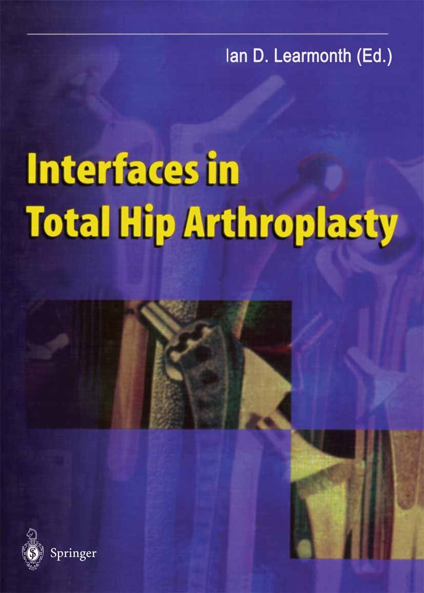 Titlebook: Interfaces in Total Hip Arthroplasty; Ian D. Learmonth (Professor and Head, Honorary Con Book 2000 Springer-Verlag London 2000 Interface.M Titlebook: Interfaces in Total Hip Arthroplasty; Ian D. Learmonth (Professor and Head, Honorary Con Book 2000 Springer-Verlag London 2000 Interface.M