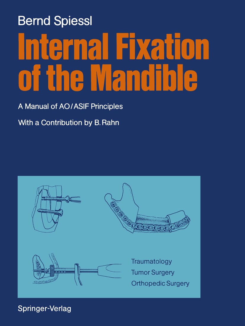Titlebook: Internal Fixation of the Mandible; A Manual of AO/ASIF Bernd Spiessl Book 1989 Springer-Verlag Berlin Heidelberg 1989 Surgery.anatomy.biom Titlebook: Internal Fixation of the Mandible; A Manual of AO/ASIF Bernd Spiessl Book 1989 Springer-Verlag Berlin Heidelberg 1989 Surgery.anatomy.biom