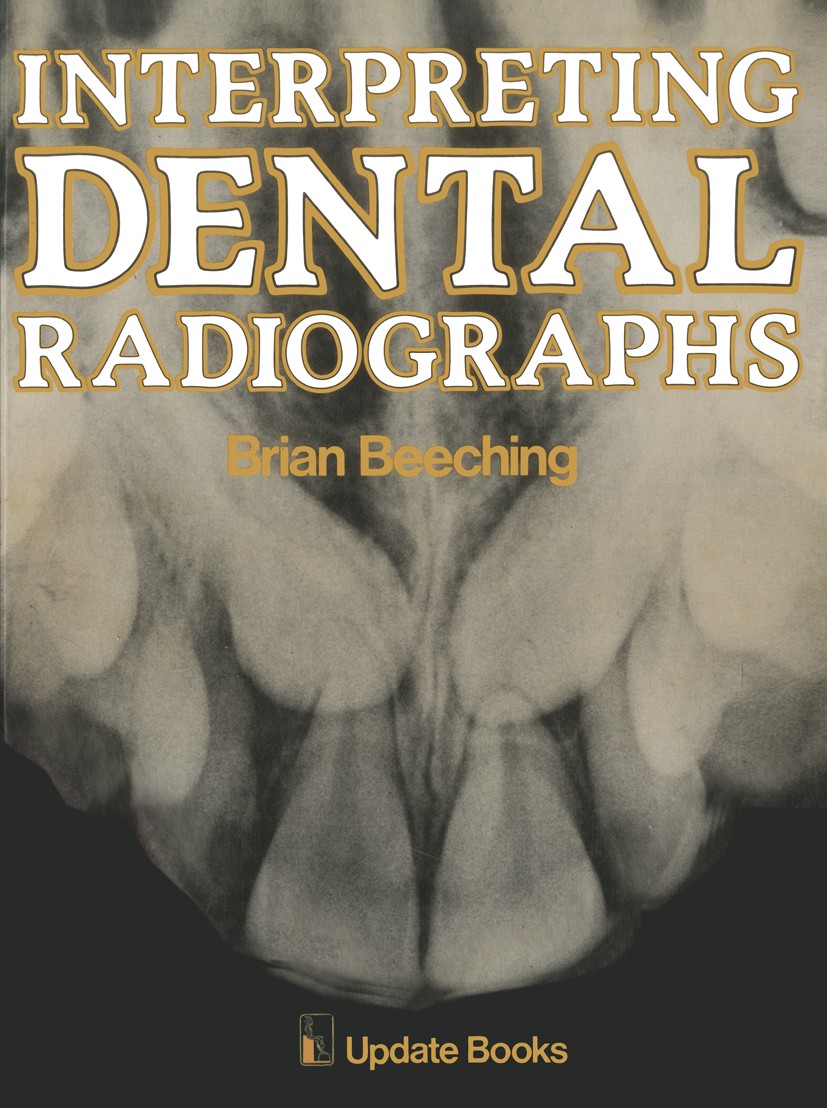 Titlebook: Interpreting Dental Radiographs; Brian W. Beeching Book 1981 Update Books Ltd 1981 anatomy.dentistry.development.radiology.trauma.treatmen Titlebook: Interpreting Dental Radiographs; Brian W. Beeching Book 1981 Update Books Ltd 1981 anatomy.dentistry.development.radiology.trauma.treatmen