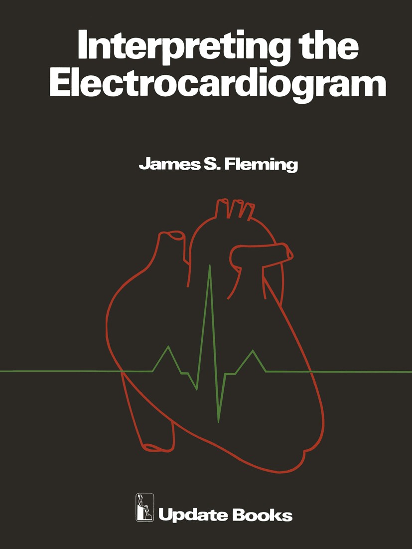 Titlebook: Interpreting the Electrocardiogram; James S. Fleming Book 1979 Update Books Ltd, James S. Fleming 1979 arrhythmia.atrial fibrillation.elec Titlebook: Interpreting the Electrocardiogram; James S. Fleming Book 1979 Update Books Ltd, James S. Fleming 1979 arrhythmia.atrial fibrillation.elec