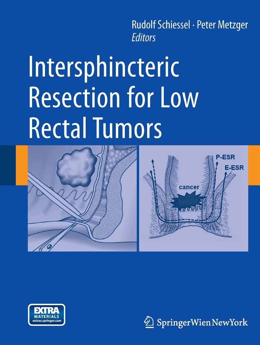 Titlebook: Intersphincteric Resection for Low Rectal Tumors; Rudolf Schiessel,Peter Metzger Book 2012 Springer-Verlag/Wien 2012 intersphincteric rese Titlebook: Intersphincteric Resection for Low Rectal Tumors; Rudolf Schiessel,Peter Metzger Book 2012 Springer-Verlag/Wien 2012 intersphincteric rese