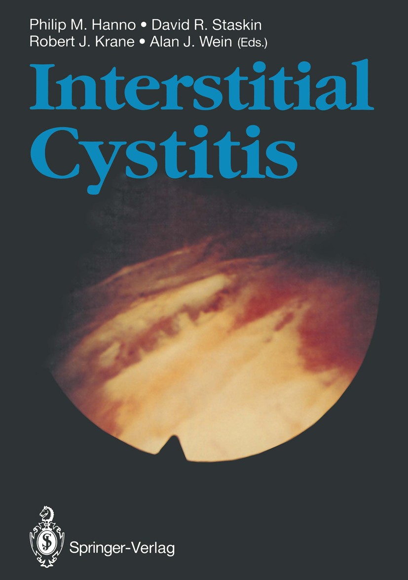 Titlebook: Interstitial Cystitis; Philip M. Hanno (Professor and Chairman),David R. Book 19901st edition Springer-Verlag London Limited 1990 Urogeni Titlebook: Interstitial Cystitis; Philip M. Hanno (Professor and Chairman),David R. Book 19901st edition Springer-Verlag London Limited 1990 Urogeni