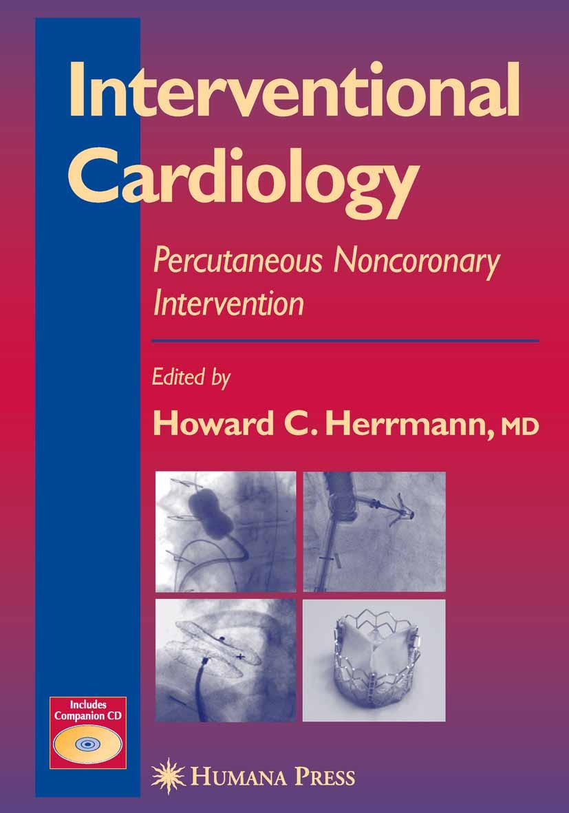 Titlebook: Interventional Cardiology; Percutaneous Noncoro Howard C. Herrmann (Professor of Medicine, Directo Book 2005 Humana Press 2005 Ablation.Ste Titlebook: Interventional Cardiology; Percutaneous Noncoro Howard C. Herrmann (Professor of Medicine, Directo Book 2005 Humana Press 2005 Ablation.Ste