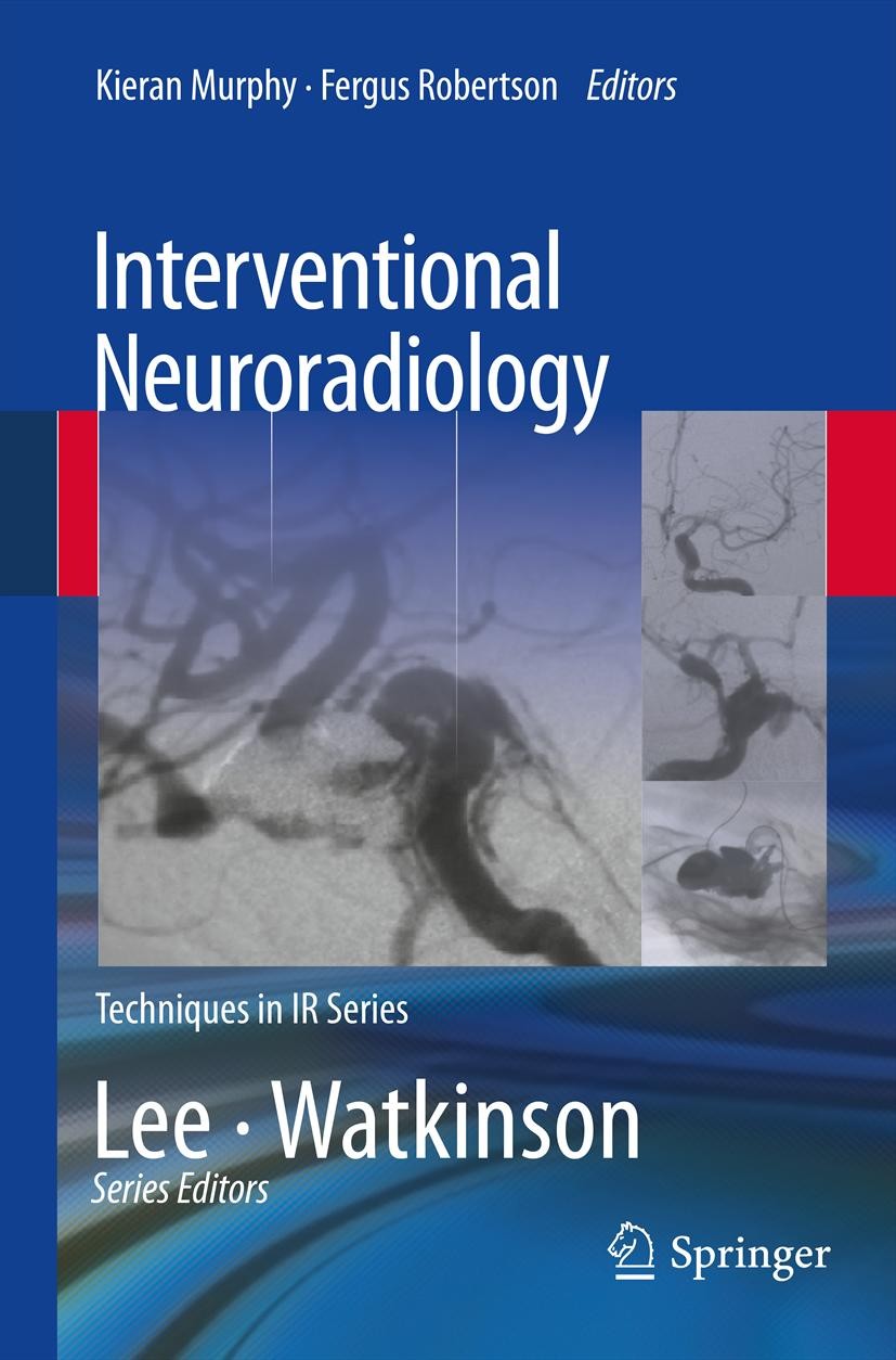 Titlebook: Interventional Neuroradiology; Kieran Murphy,Fergus Robertson Book 2014 Springer-Verlag London 2014 Aneurism.Arterio-venous Malformation.C Titlebook: Interventional Neuroradiology; Kieran Murphy,Fergus Robertson Book 2014 Springer-Verlag London 2014 Aneurism.Arterio-venous Malformation.C