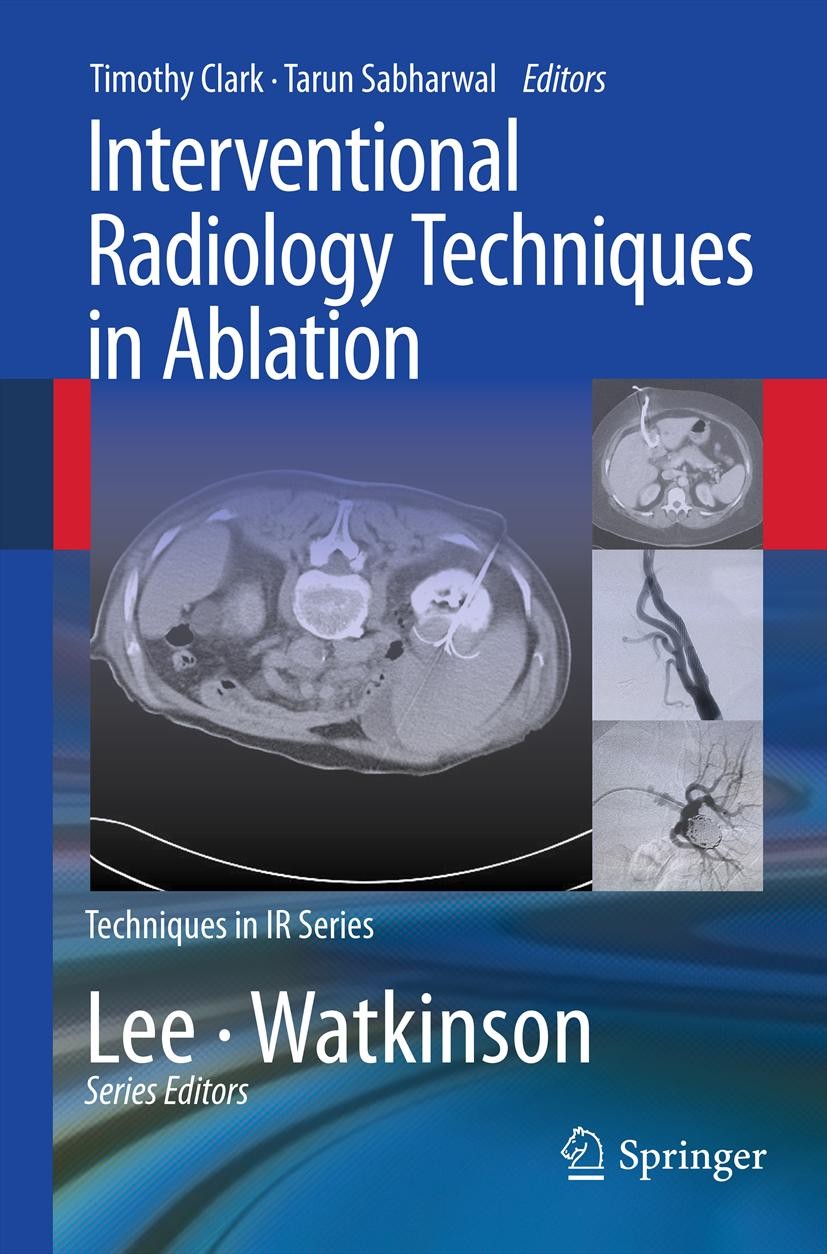 Titlebook: Interventional Radiology Techniques in Ablation; Timothy Clark,Tarun Sabharwal Book 2013 Springer-Verlag London 2013 Diagnostic Radiology. Titlebook: Interventional Radiology Techniques in Ablation; Timothy Clark,Tarun Sabharwal Book 2013 Springer-Verlag London 2013 Diagnostic Radiology.