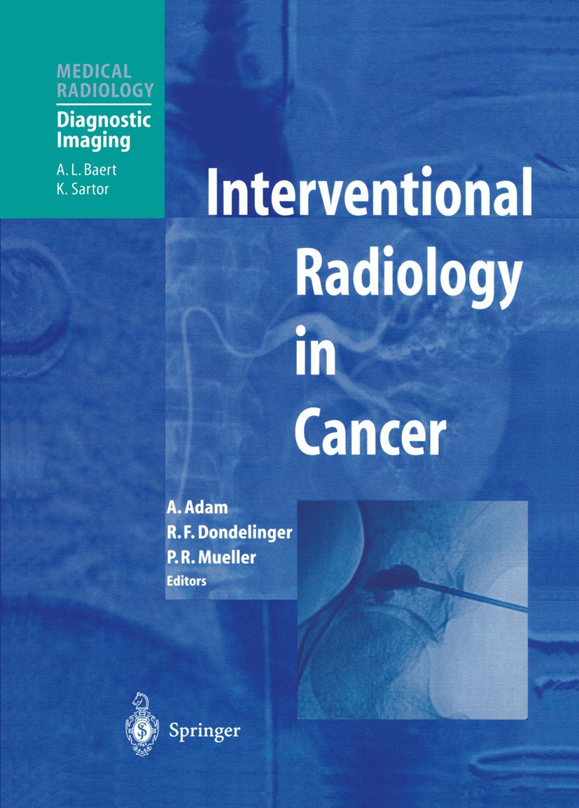 Titlebook: Interventional Radiology in Cancer; Andreas Adam (Professor of Interventional Radiolog Book 2004 Springer-Verlag Berlin Heidelberg 2004 In Titlebook: Interventional Radiology in Cancer; Andreas Adam (Professor of Interventional Radiolog Book 2004 Springer-Verlag Berlin Heidelberg 2004 In