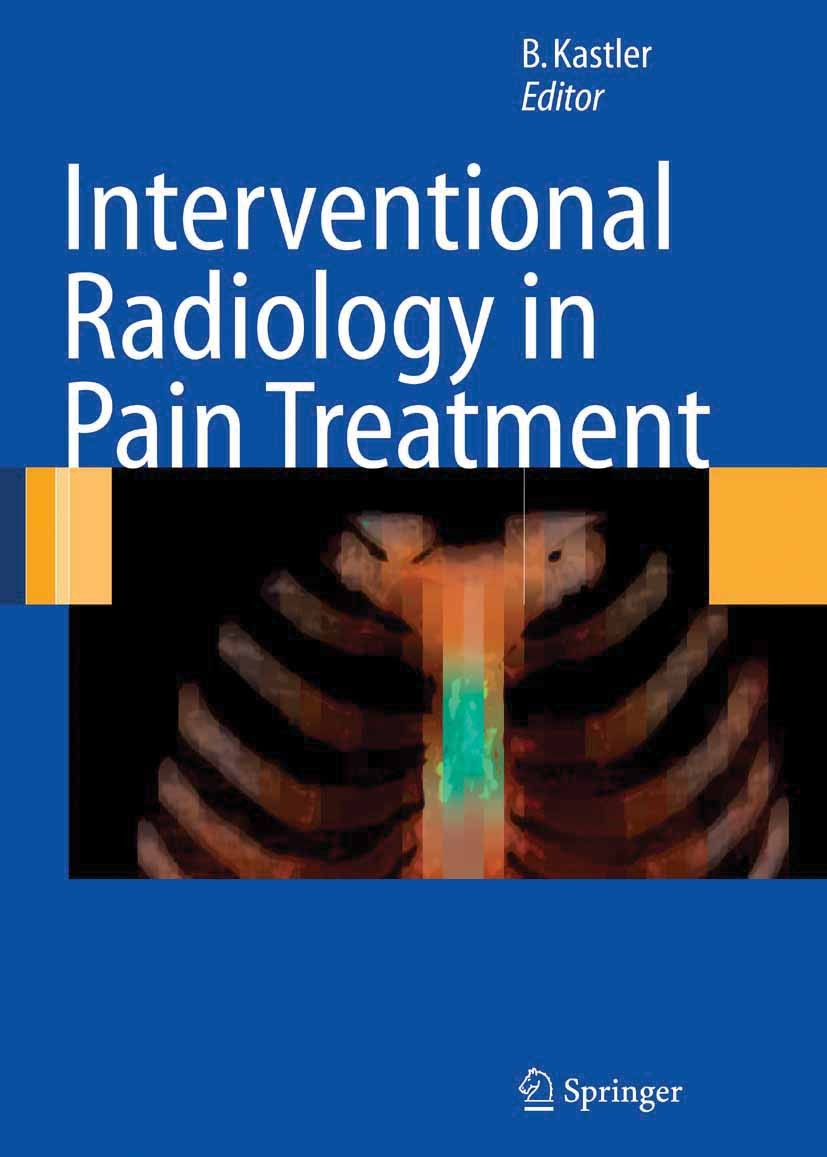 Titlebook: Interventional Radiology in Pain Treatment; Bruno Kastler (Professor of Radiology, Head of Rad Book 2007 Springer-Verlag Berlin Heidelberg Titlebook: Interventional Radiology in Pain Treatment; Bruno Kastler (Professor of Radiology, Head of Rad Book 2007 Springer-Verlag Berlin Heidelberg