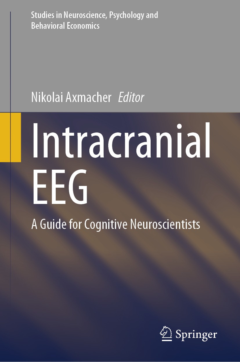 Titlebook: Intracranial EEG; A Guide for Cognitiv Nikolai Axmacher Book 2023 The Editor(s) (if applicable) and The Author(s), under exclusive license Titlebook: Intracranial EEG; A Guide for Cognitiv Nikolai Axmacher Book 2023 The Editor(s) (if applicable) and The Author(s), under exclusive license
