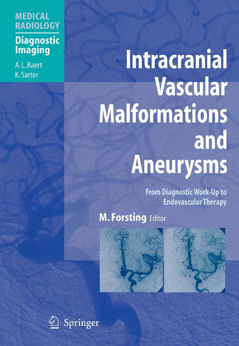 Titlebook: Intracranial Vascular Malformations and Aneurysms; From Diagnostic Work C. Cognard,A. Dörfler,I. Wanke Book 20041st edition Springer-Verlag Titlebook: Intracranial Vascular Malformations and Aneurysms; From Diagnostic Work C. Cognard,A. Dörfler,I. Wanke Book 20041st edition Springer-Verlag