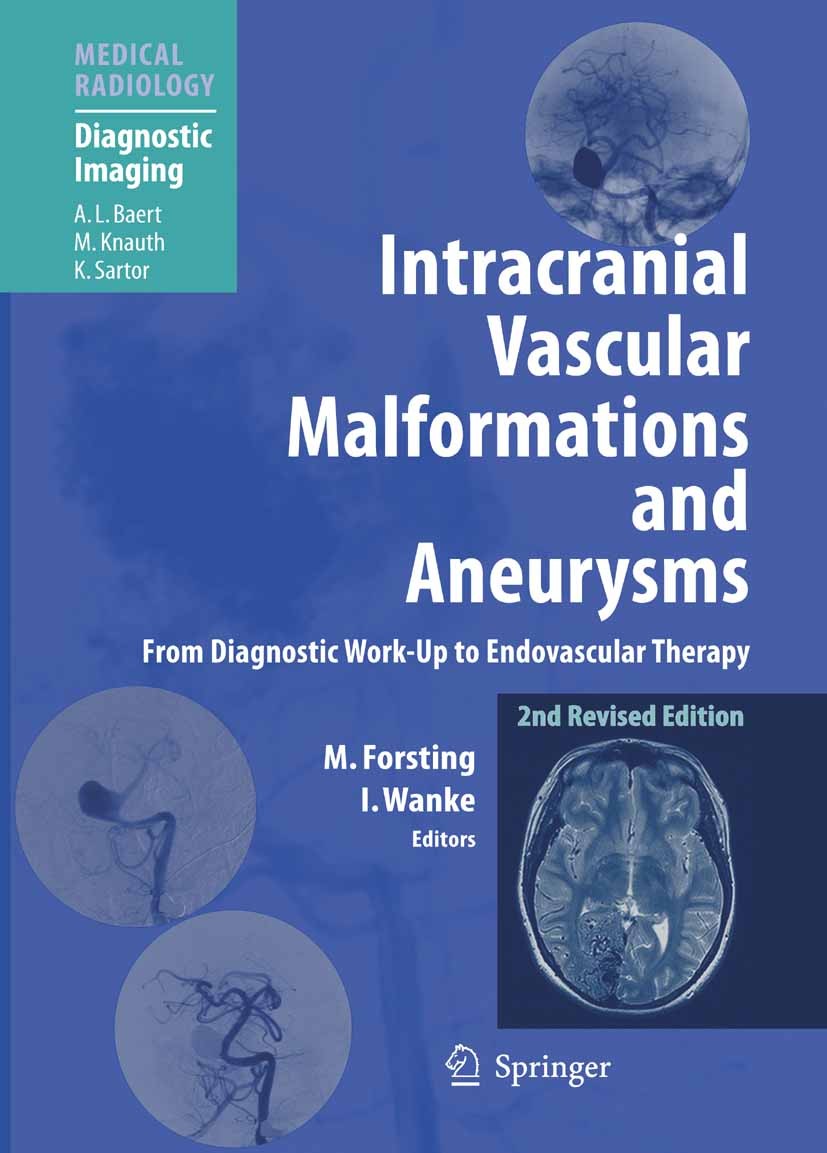 Titlebook: Intracranial Vascular Malformations and Aneurysms; From Diagnostic Work Michael Forsting (Director),Isabel Wanke (Director Book 2008Latest Titlebook: Intracranial Vascular Malformations and Aneurysms; From Diagnostic Work Michael Forsting (Director),Isabel Wanke (Director Book 2008Latest