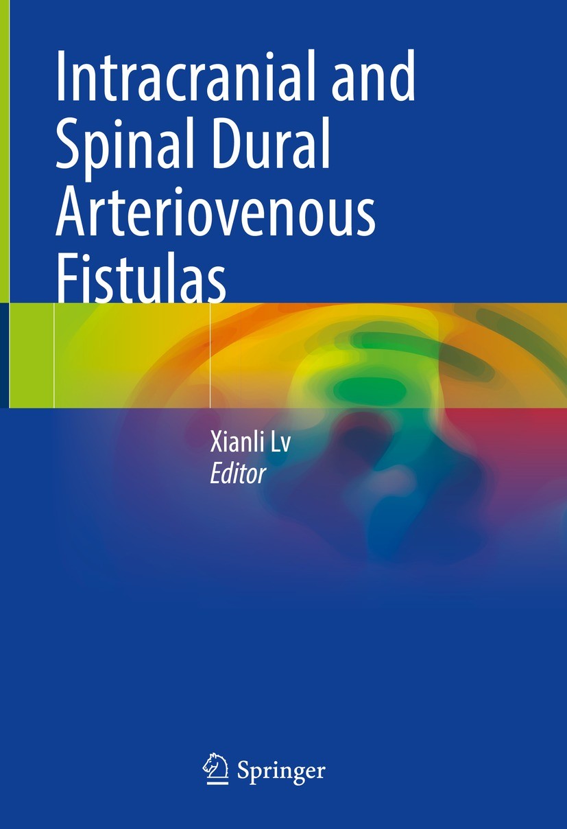 Titlebook: Intracranial and Spinal Dural Arteriovenous Fistulas; Xianli Lv Book 2022 The Editor(s) (if applicable) and The Author(s), under exclusive Titlebook: Intracranial and Spinal Dural Arteriovenous Fistulas; Xianli Lv Book 2022 The Editor(s) (if applicable) and The Author(s), under exclusive