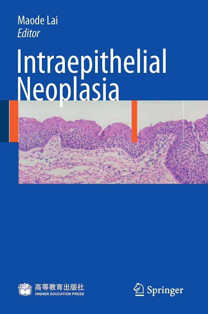 Titlebook: Intraepithelial Neoplasia; Maode Lai Book 2009Latest edition Springer-Verlag Berlin Heidelberg 2009 HEP.Intraepithelial neoplasia.Oncology Titlebook: Intraepithelial Neoplasia; Maode Lai Book 2009Latest edition Springer-Verlag Berlin Heidelberg 2009 HEP.Intraepithelial neoplasia.Oncology