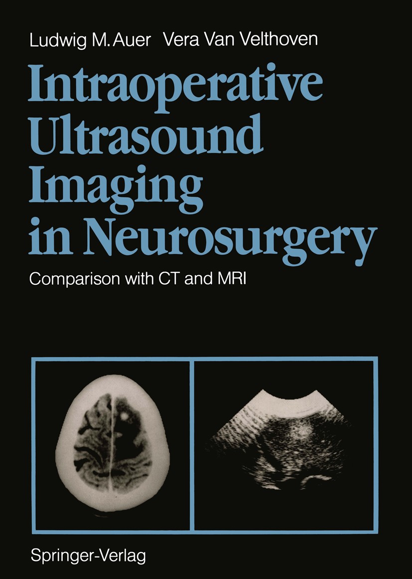 Titlebook: Intraoperative Ultrasound Imaging in Neurosurgery; Comparison with CT a Ludwig M. Auer,Vera Velthoven Book 1990 Springer-Verlag Berlin Heid Titlebook: Intraoperative Ultrasound Imaging in Neurosurgery; Comparison with CT a Ludwig M. Auer,Vera Velthoven Book 1990 Springer-Verlag Berlin Heid