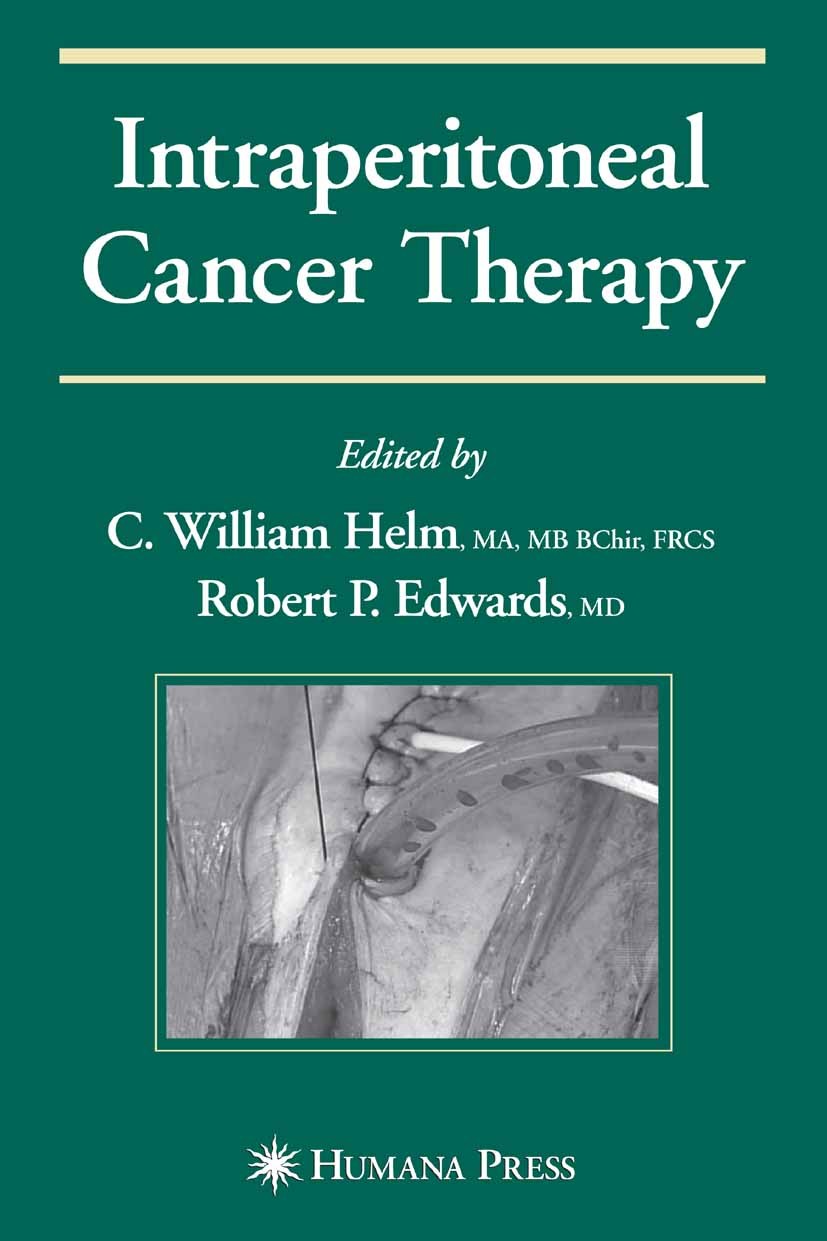 Titlebook: Intraperitoneal Cancer Therapy; C. William Helm,Robert P. Edwards (Vice Chairman o Book 2007 Humana Press 2007 cancer.carcinoma.clinical t Titlebook: Intraperitoneal Cancer Therapy; C. William Helm,Robert P. Edwards (Vice Chairman o Book 2007 Humana Press 2007 cancer.carcinoma.clinical t