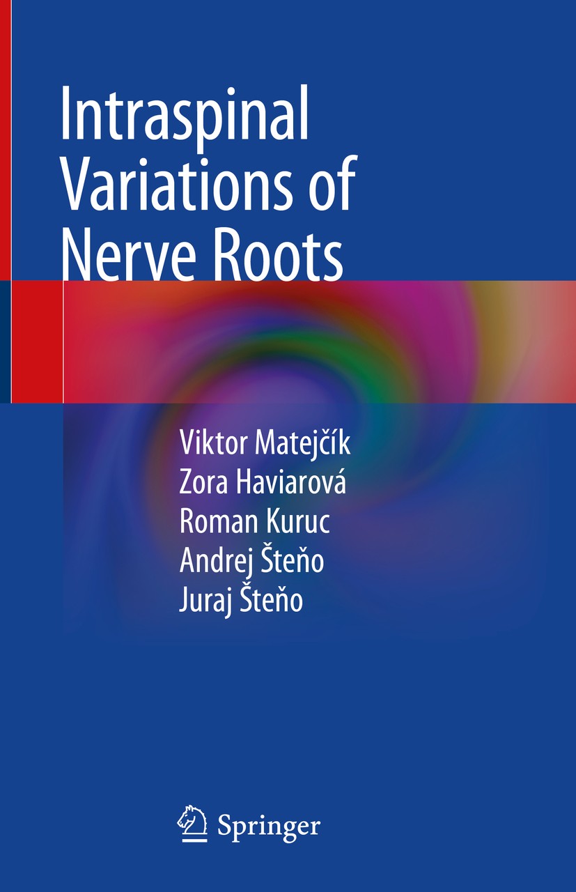 Titlebook: Intraspinal Variations of Nerve Roots; Viktor Matejčík,Zora Haviarová,Juraj Šteňo Book 2019 Springer Nature Switzerland AG 2019 Spinal Ner Titlebook: Intraspinal Variations of Nerve Roots; Viktor Matejčík,Zora Haviarová,Juraj Šteňo Book 2019 Springer Nature Switzerland AG 2019 Spinal Ner
