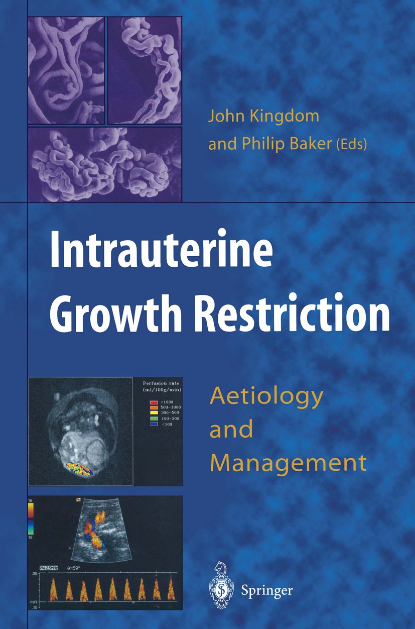 Titlebook: Intrauterine Growth Restriction; Aetiology and Manage John Kingdom,Philip Baker Book 2000 Springer-Verlag London Limited 2000 anatomy.birth Titlebook: Intrauterine Growth Restriction; Aetiology and Manage John Kingdom,Philip Baker Book 2000 Springer-Verlag London Limited 2000 anatomy.birth