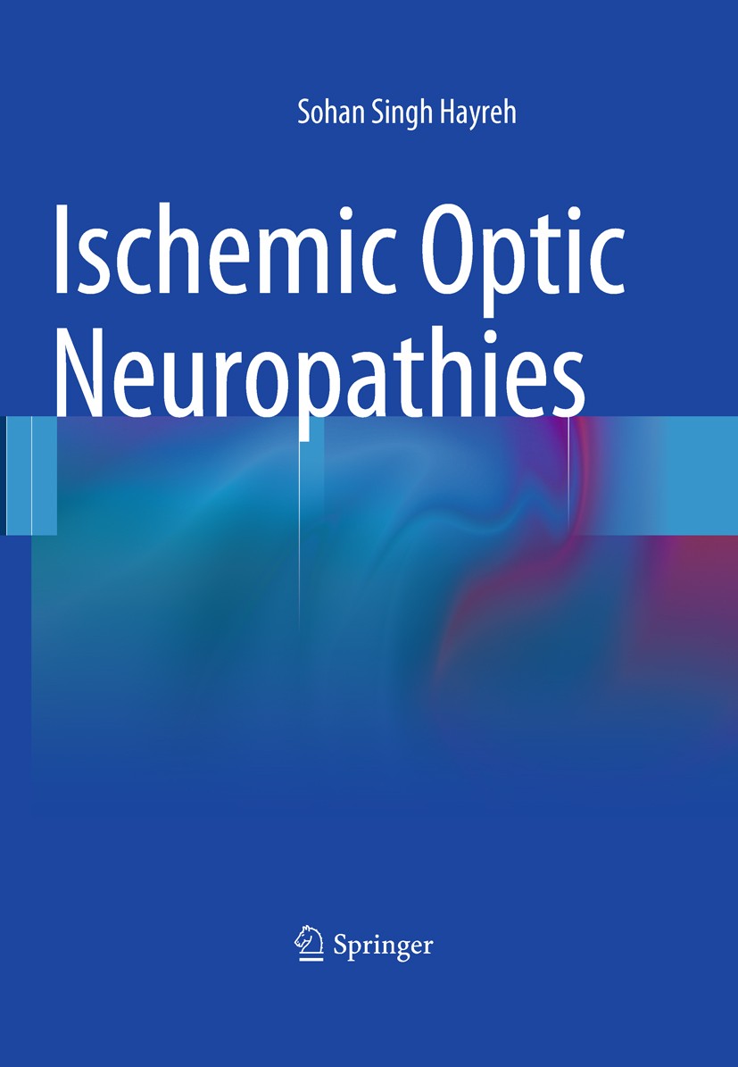 Titlebook: Ischemic Optic Neuropathies; Sohan Singh Hayreh Book 2011 The Editor(s) (if applicable) and The Author(s), under exclusive license to Spri Titlebook: Ischemic Optic Neuropathies; Sohan Singh Hayreh Book 2011 The Editor(s) (if applicable) and The Author(s), under exclusive license to Spri