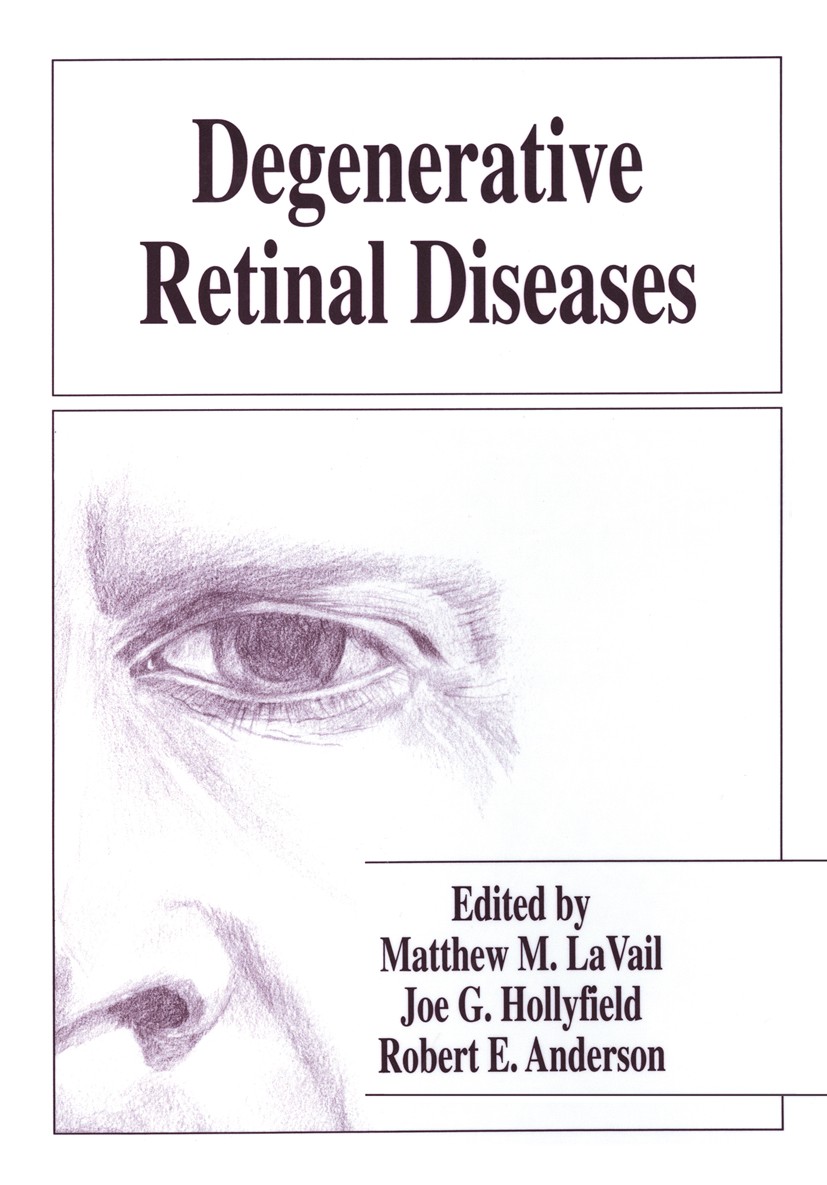 Titlebook: Degenerative Retinal Diseases; Matthew M. LaVail,Joe G. Hollyfield,Robert E. Ande Book 1997 Springer Science+Business Media New York 1997 Titlebook: Degenerative Retinal Diseases; Matthew M. LaVail,Joe G. Hollyfield,Robert E. Ande Book 1997 Springer Science+Business Media New York 1997