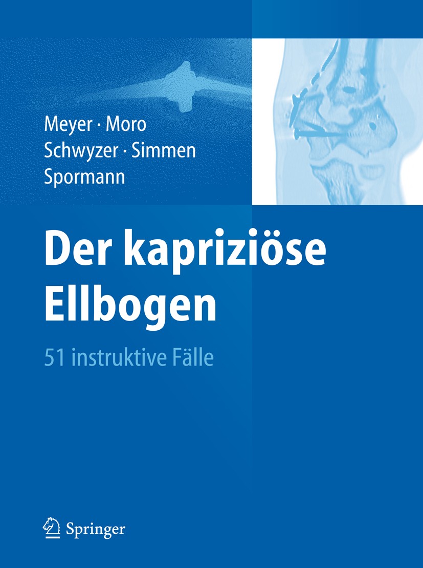 Titlebook: Der kapriziöse Ellbogen; 51 instruktive Fälle Rainer-Peter Meyer,Fabrizio Moro,Christoph Sporman Book 2012 Springer-Verlag Berlin Heidelber Titlebook: Der kapriziöse Ellbogen; 51 instruktive Fälle Rainer-Peter Meyer,Fabrizio Moro,Christoph Sporman Book 2012 Springer-Verlag Berlin Heidelber