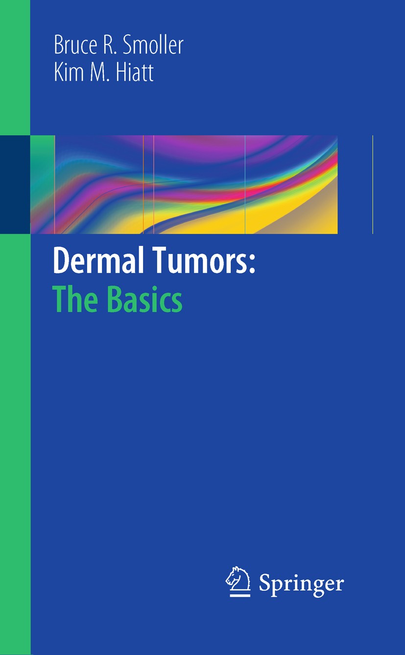 Titlebook: Dermal Tumors: The Basics; Bruce R. Smoller,Kim M. Hiatt Book 2011 Springer-Verlag Berlin Heidelberg 2011 Cutaneous Lymphomas.Fibrohistioc Titlebook: Dermal Tumors: The Basics; Bruce R. Smoller,Kim M. Hiatt Book 2011 Springer-Verlag Berlin Heidelberg 2011 Cutaneous Lymphomas.Fibrohistioc