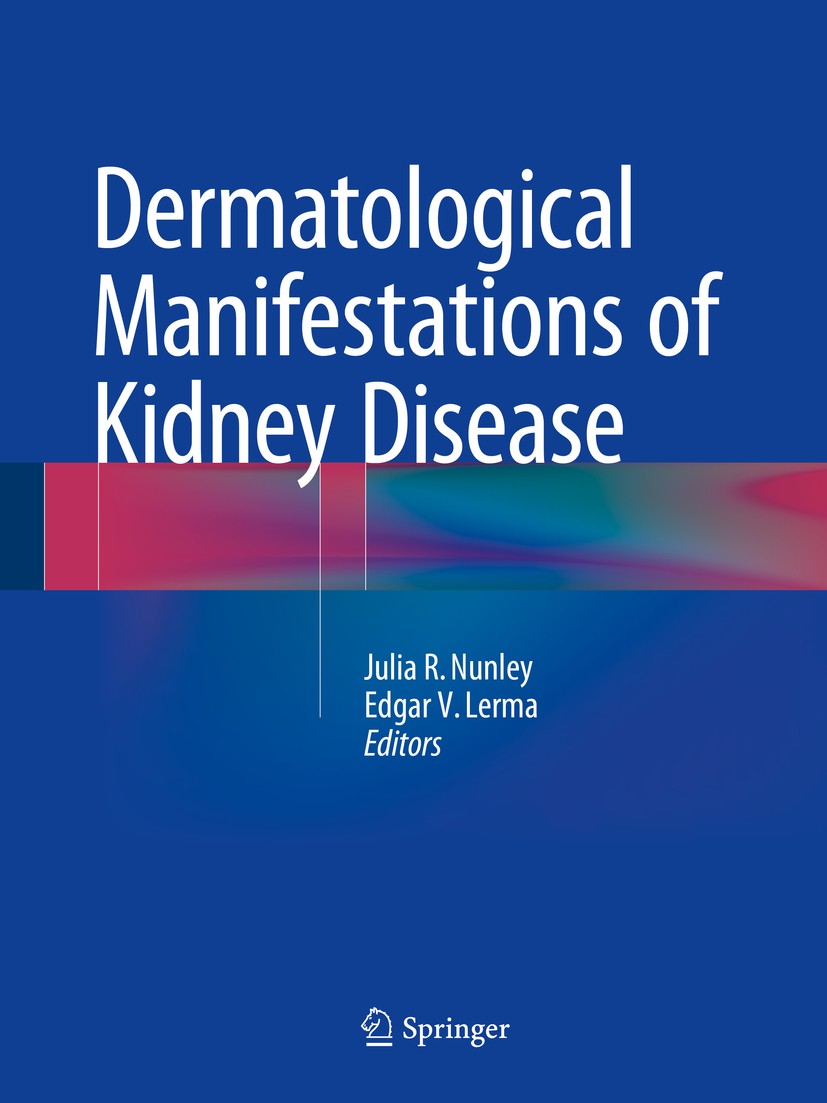 Titlebook: Dermatological Manifestations of Kidney Disease; Julia R. Nunley,Edgar V. Lerma Book 2015 Springer Science+Business Media New York 2015 De Titlebook: Dermatological Manifestations of Kidney Disease; Julia R. Nunley,Edgar V. Lerma Book 2015 Springer Science+Business Media New York 2015 De