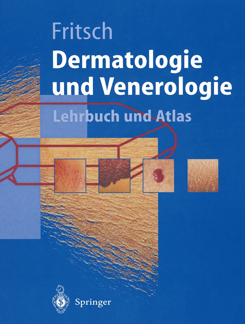Titlebook: Dermatologie und Venerologie; Lehrbuch und Atlas Peter Fritsch Textbook 19981st edition Springer-Verlag Berlin Heidelberg 1998 Allergologie Titlebook: Dermatologie und Venerologie; Lehrbuch und Atlas Peter Fritsch Textbook 19981st edition Springer-Verlag Berlin Heidelberg 1998 Allergologie
