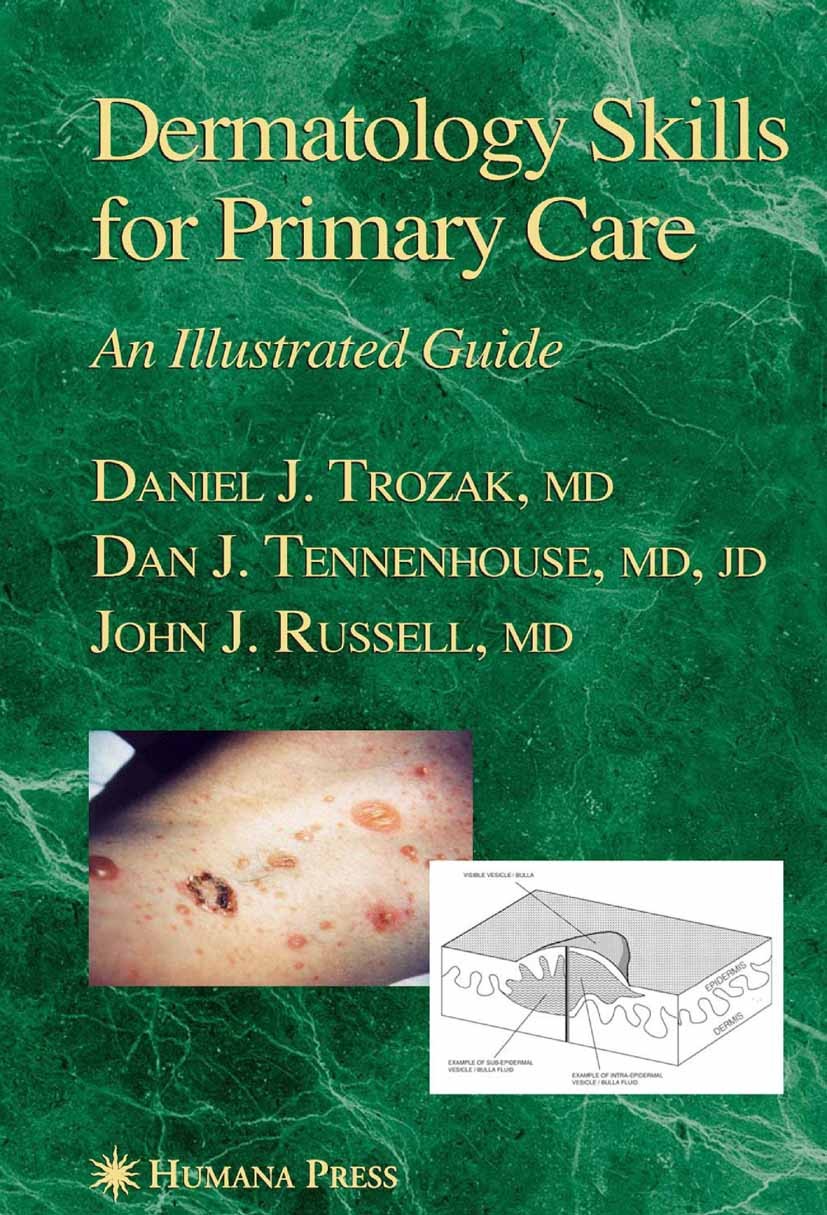 Titlebook: Dermatology Skills for Primary Care; An Illustrated Guide Daniel J. Trozak,Dan J. Tennenhouse,John J. Russel Book 2006 Humana Press 2006 Er Titlebook: Dermatology Skills for Primary Care; An Illustrated Guide Daniel J. Trozak,Dan J. Tennenhouse,John J. Russel Book 2006 Humana Press 2006 Er
