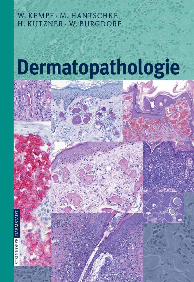 Titlebook: Dermatopathologie; Werner Kempf,Markus Hantschke,Walter Burgdorf Book 20071st edition Steinkopff-Verlag Darmstadt 2007 Biopsie.Dermatologi Titlebook: Dermatopathologie; Werner Kempf,Markus Hantschke,Walter Burgdorf Book 20071st edition Steinkopff-Verlag Darmstadt 2007 Biopsie.Dermatologi