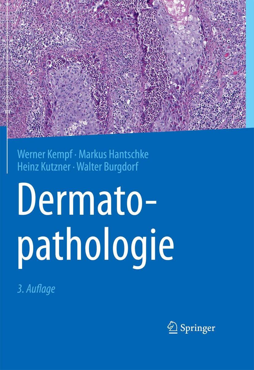 Titlebook: Dermatopathologie; Werner Kempf,Markus Hantschke,Walter Burgdorf Book 20153rd edition Springer-Verlag Berlin Heidelberg 2015 Dermatohistop Titlebook: Dermatopathologie; Werner Kempf,Markus Hantschke,Walter Burgdorf Book 20153rd edition Springer-Verlag Berlin Heidelberg 2015 Dermatohistop