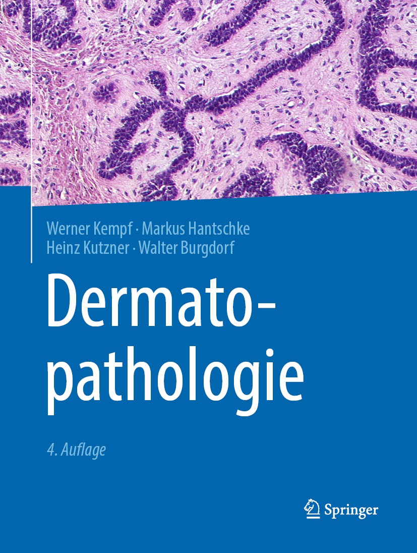 Titlebook: Dermatopathologie; Werner Kempf,Markus Hantschke,Walter Burgdorf Book 2020Latest edition Springer-Verlag GmbH Deutschland, ein Teil von Sp Titlebook: Dermatopathologie; Werner Kempf,Markus Hantschke,Walter Burgdorf Book 2020Latest edition Springer-Verlag GmbH Deutschland, ein Teil von Sp