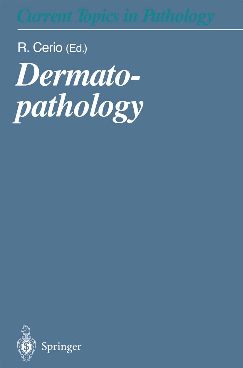Titlebook: Dermatopathology; R. Cerio Book 2001 Springer-Verlag Berlin Heidelberg 2001 Dermatopathologie.Dermatoses.Haut.Skin Pathology.dermatopathol Titlebook: Dermatopathology; R. Cerio Book 2001 Springer-Verlag Berlin Heidelberg 2001 Dermatopathologie.Dermatoses.Haut.Skin Pathology.dermatopathol