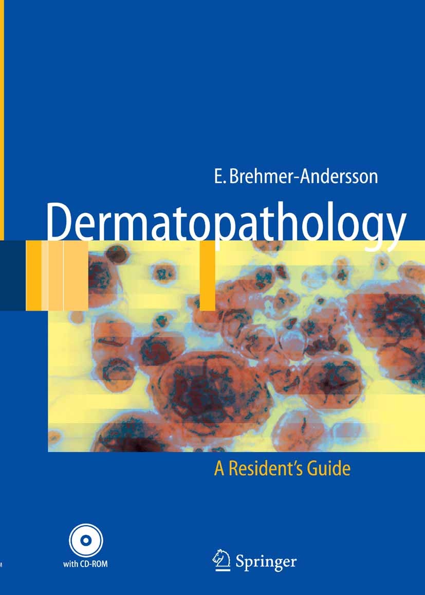Titlebook: Dermatopathology; Eva Brehmer-Andersson Book 2006 Springer-Verlag Berlin Heidelberg 2006 Herpes simplex.histopathology.immunology.inflamma Titlebook: Dermatopathology; Eva Brehmer-Andersson Book 2006 Springer-Verlag Berlin Heidelberg 2006 Herpes simplex.histopathology.immunology.inflamma