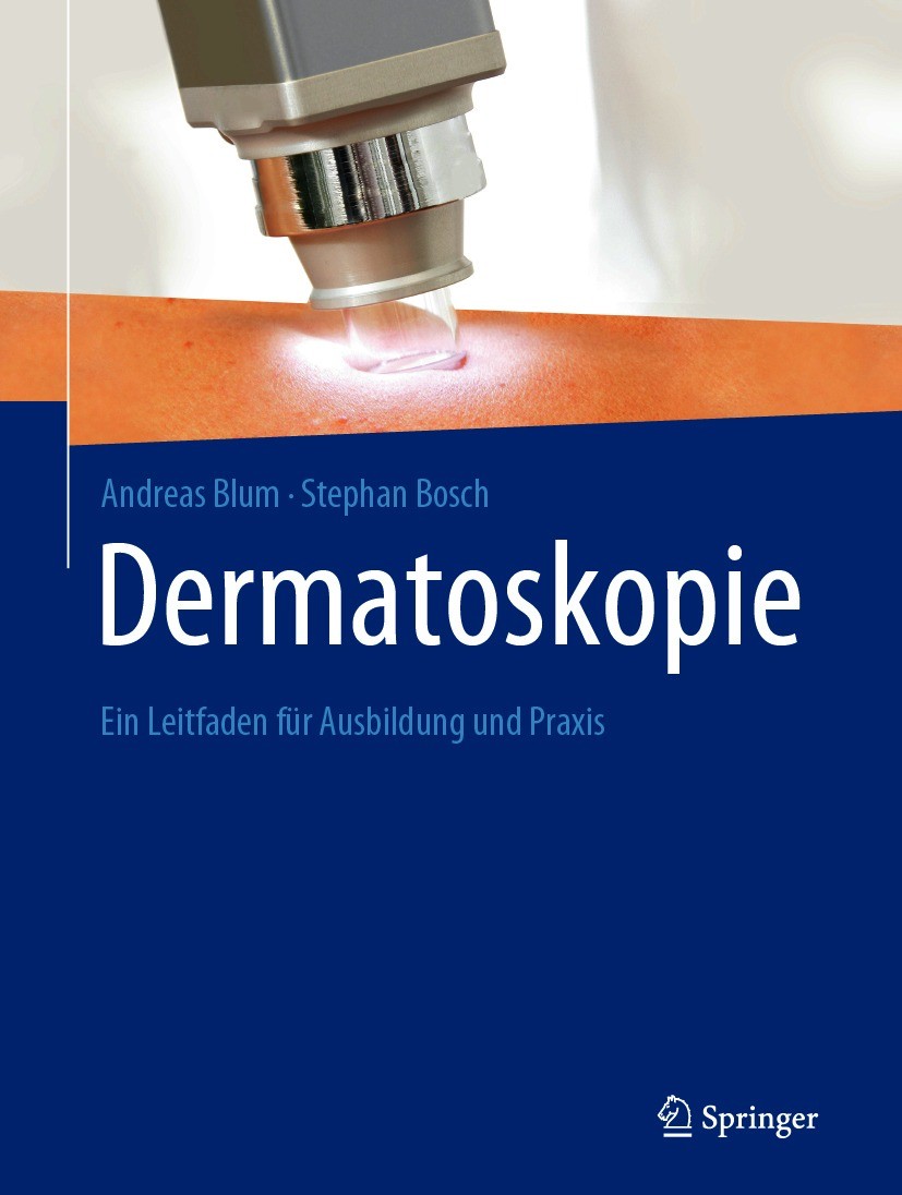 Titlebook: Dermatoskopie; Ein Leitfaden für Au Andreas Blum,Stephan Bosch Book 2020 Der/die Herausgeber bzw. der/die Autor(en), exklusiv lizenziert du Titlebook: Dermatoskopie; Ein Leitfaden für Au Andreas Blum,Stephan Bosch Book 2020 Der/die Herausgeber bzw. der/die Autor(en), exklusiv lizenziert du