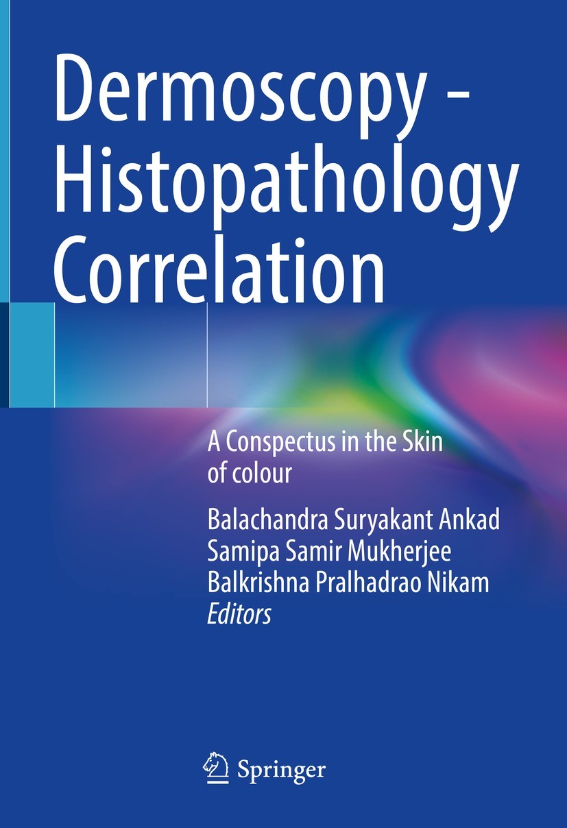 Titlebook: Dermoscopy - Histopathology Correlation; A Conspectus in the Balachandra Suryakant Ankad,Samipa Samir Mukherjee Book 2021 Springer Nature Titlebook: Dermoscopy - Histopathology Correlation; A Conspectus in the Balachandra Suryakant Ankad,Samipa Samir Mukherjee Book 2021 Springer Nature
