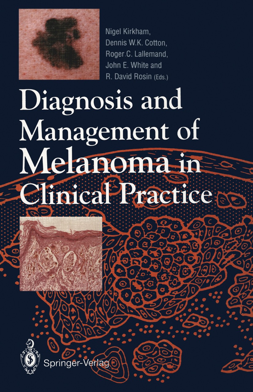 Titlebook: Diagnosis and Management of Melanoma in Clinical Practice; Nigel Kirkham (Consultant Pathologist),Dennis W. K Book 1992 Springer-Verlag Lo Titlebook: Diagnosis and Management of Melanoma in Clinical Practice; Nigel Kirkham (Consultant Pathologist),Dennis W. K Book 1992 Springer-Verlag Lo