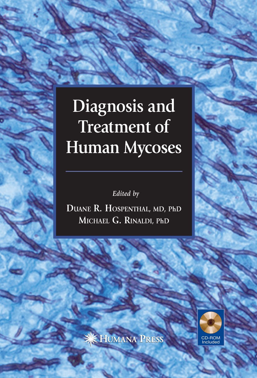 Titlebook: Diagnosis and Treatment of Human Mycoses; Duane R. Hospenthal,Michael G. Rinaldi Book 20081st edition Humana Press 2008 fungal infection.i Titlebook: Diagnosis and Treatment of Human Mycoses; Duane R. Hospenthal,Michael G. Rinaldi Book 20081st edition Humana Press 2008 fungal infection.i