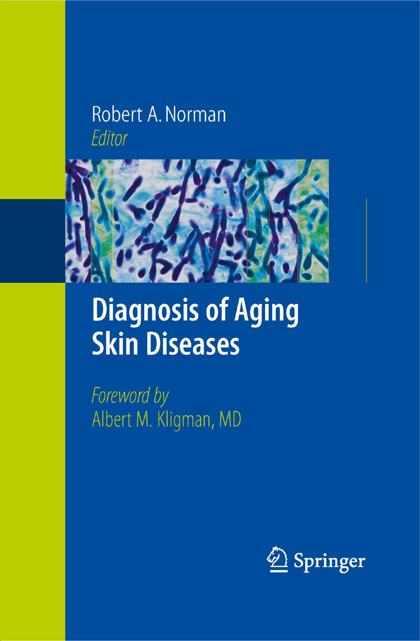 Titlebook: Diagnosis of Aging Skin Diseases; Robert A. Norman Book 2008 Springer-Verlag London 2008 Aging skin.Blistering skin diseases.Dermatology.D Titlebook: Diagnosis of Aging Skin Diseases; Robert A. Norman Book 2008 Springer-Verlag London 2008 Aging skin.Blistering skin diseases.Dermatology.D