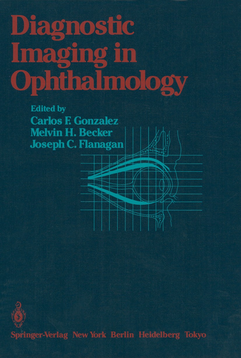 Titlebook: Diagnostic Imaging in Ophthalmology; Carlos F. Gonzalez (Professor of Radiology),Melvin Book 1986 Springer-Verlag New York, Inc. 1986 Tumo Titlebook: Diagnostic Imaging in Ophthalmology; Carlos F. Gonzalez (Professor of Radiology),Melvin Book 1986 Springer-Verlag New York, Inc. 1986 Tumo