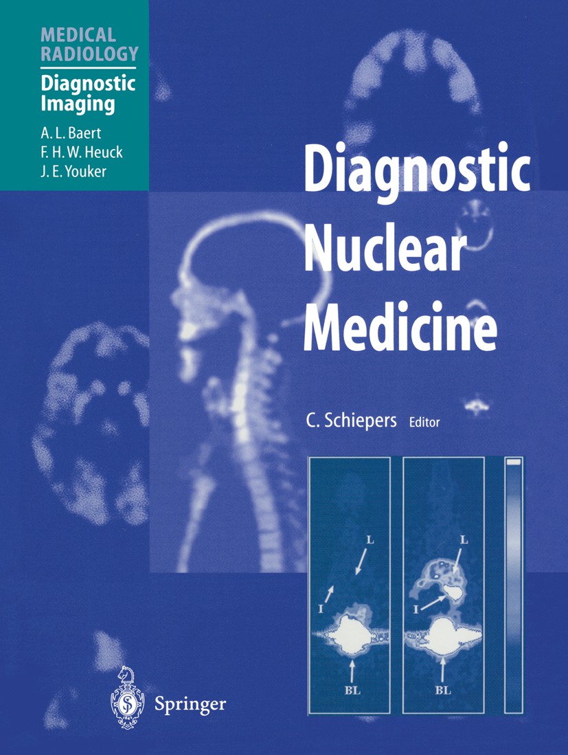 Titlebook: Diagnostic Nuclear Medicine; Christiaan Schiepers (Associate Professor) Book 20001st edition Springer-Verlag Berlin Heidelberg 2000 Gene I Titlebook: Diagnostic Nuclear Medicine; Christiaan Schiepers (Associate Professor) Book 20001st edition Springer-Verlag Berlin Heidelberg 2000 Gene I