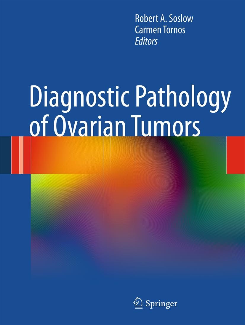 Titlebook: Diagnostic Pathology of Ovarian Tumors; Robert A. Soslow,Carmen Tornos Book 2011 Springer Science+Business Media, LLC 2011 Titlebook: Diagnostic Pathology of Ovarian Tumors; Robert A. Soslow,Carmen Tornos Book 2011 Springer Science+Business Media, LLC 2011
