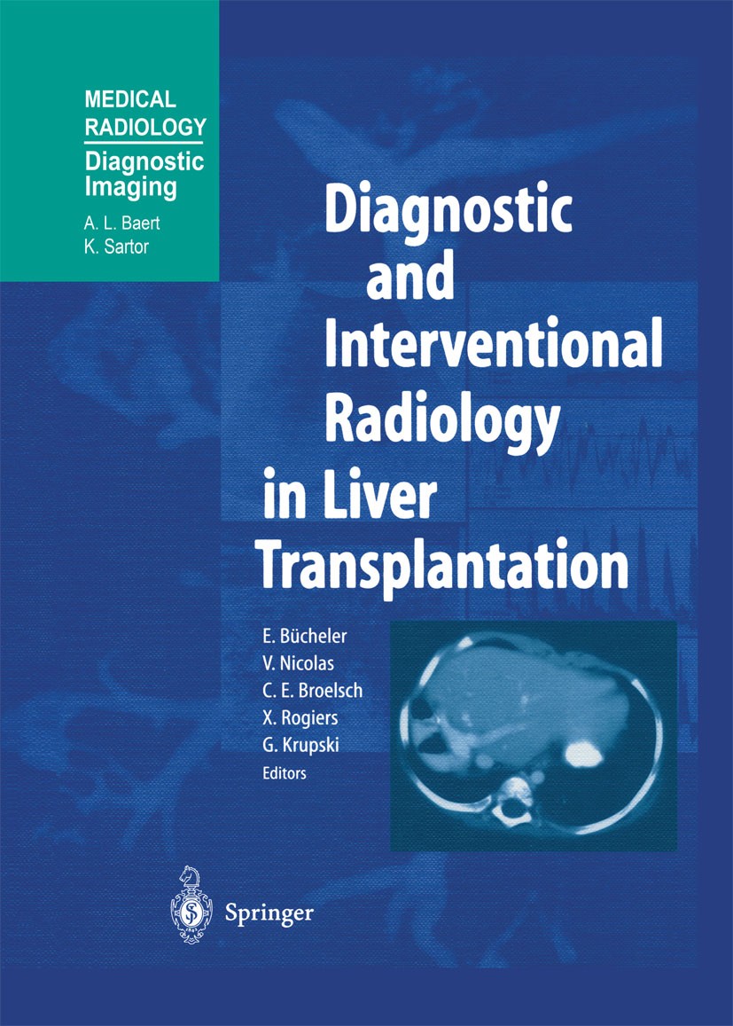 Titlebook: Diagnostic and Interventional Radiology in Liver Transplantation; E. Bücheler (Professor),V. Nicolas (Professor),G. Book 2003 Springer-Ve Titlebook: Diagnostic and Interventional Radiology in Liver Transplantation; E. Bücheler (Professor),V. Nicolas (Professor),G. Book 2003 Springer-Ve