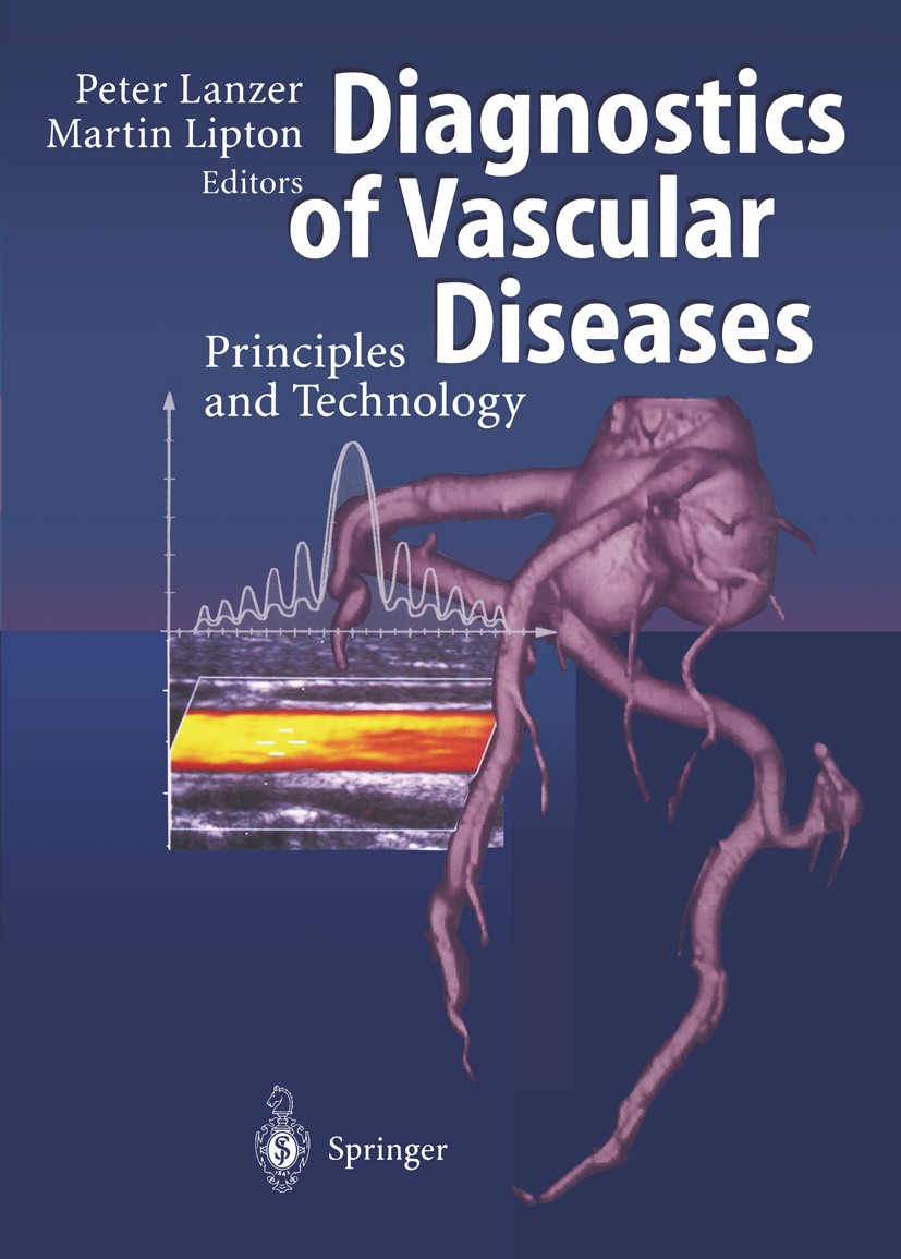 Titlebook: Diagnostics of Vascular Diseases; Principles and Techn Peter Lanzer,Martin Lipton Book 1997 Springer-Verlag Berlin Heidelberg 1997 cardiova Titlebook: Diagnostics of Vascular Diseases; Principles and Techn Peter Lanzer,Martin Lipton Book 1997 Springer-Verlag Berlin Heidelberg 1997 cardiova