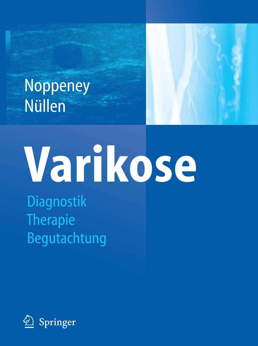 Titlebook: Varikose; Diagnostik - Therapi Thomas Noppeney,Helmut Nüllen Book 20101st edition Springer-Verlag Berlin Heidelberg 2010 Anästhesie.Chirurg Titlebook: Varikose; Diagnostik - Therapi Thomas Noppeney,Helmut Nüllen Book 20101st edition Springer-Verlag Berlin Heidelberg 2010 Anästhesie.Chirurg