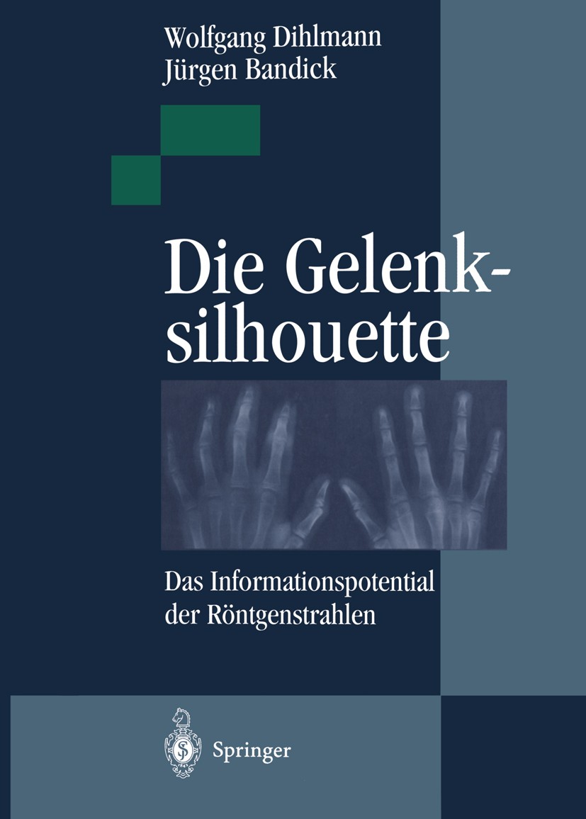 Titlebook: Die Gelenksilhouette; Das Informationspote Wolfgang Dihlmann,Jürgen Bandick Book 1995 Springer-Verlag Berlin Heidelberg 1995 Arthrose.Diagn Titlebook: Die Gelenksilhouette; Das Informationspote Wolfgang Dihlmann,Jürgen Bandick Book 1995 Springer-Verlag Berlin Heidelberg 1995 Arthrose.Diagn