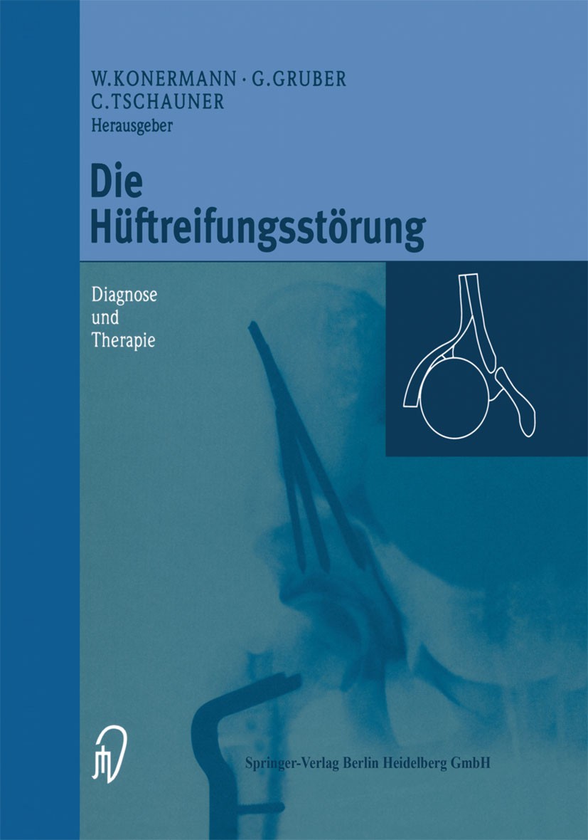 Titlebook: Die Hüftreifungsstörung; Diagnose und Therapi Werner Konermann,Gerd Gruber,Christian Tschauner Book 1999 Springer-Verlag Berlin Heidelberg Titlebook: Die Hüftreifungsstörung; Diagnose und Therapi Werner Konermann,Gerd Gruber,Christian Tschauner Book 1999 Springer-Verlag Berlin Heidelberg