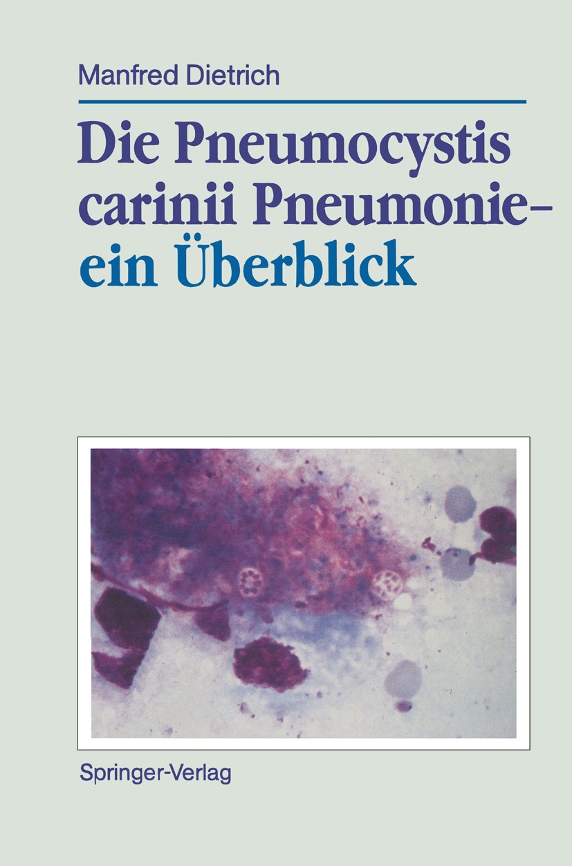 Titlebook: Die Pneumocystis carinii Pneumonie— ein Überblick; Manfred Dietrich Book 1989 Springer-Verlag Berlin Heidelberg 1989 AIDS.Chemotherapie.Fo Titlebook: Die Pneumocystis carinii Pneumonie— ein Überblick; Manfred Dietrich Book 1989 Springer-Verlag Berlin Heidelberg 1989 AIDS.Chemotherapie.Fo