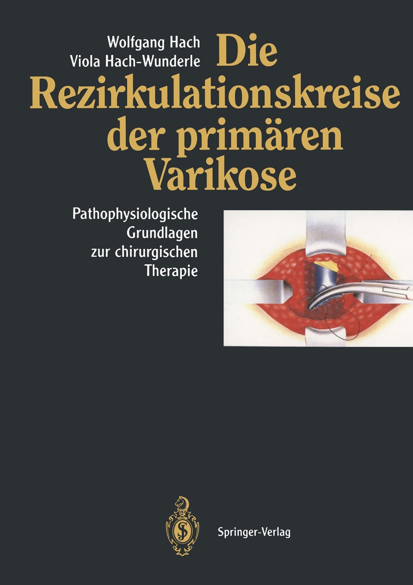 Titlebook: Die Rezirkulationskreise der primären Varikose; Pathophysiologische Wolfgang Hach,Viola Hach-Wunderle Book 1994 Springer-Verlag Berlin Hei Titlebook: Die Rezirkulationskreise der primären Varikose; Pathophysiologische Wolfgang Hach,Viola Hach-Wunderle Book 1994 Springer-Verlag Berlin Hei