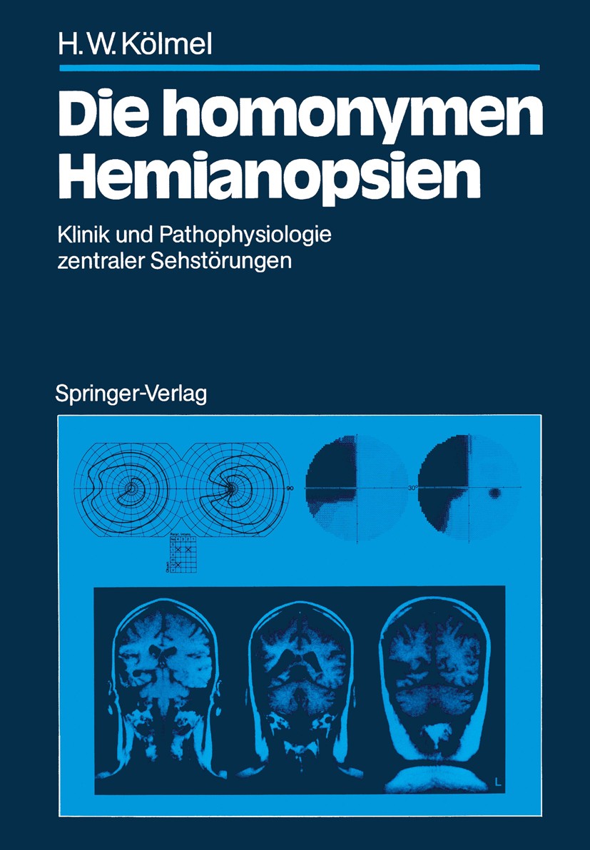 Titlebook: Die homonymen Hemianopsien; Klinik und Pathophys Hans Wolfgang Kölmel Book 1988 Springer-Verlag Berlin Heidelberg 1988 Anatomie.Ergotherapi Titlebook: Die homonymen Hemianopsien; Klinik und Pathophys Hans Wolfgang Kölmel Book 1988 Springer-Verlag Berlin Heidelberg 1988 Anatomie.Ergotherapi