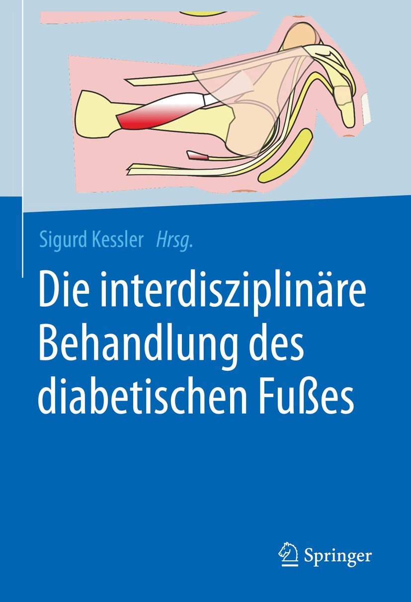 Titlebook: Die interdisziplinäre Behandlung des diabetischen Fußes; Sigurd Kessler Book 2022 Springer-Verlag GmbH Deutschland, ein Teil von Springer Titlebook: Die interdisziplinäre Behandlung des diabetischen Fußes; Sigurd Kessler Book 2022 Springer-Verlag GmbH Deutschland, ein Teil von Springer